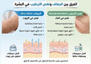ما الفرق بين الجفاف ونقص الترطيب في البشرة